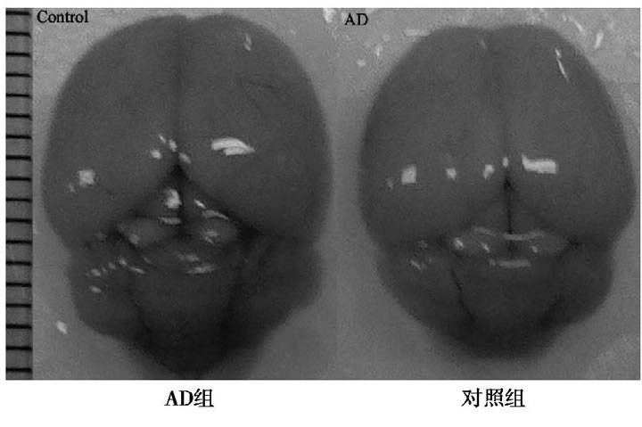 圖1 AD組和對照組小鼠全腦圖